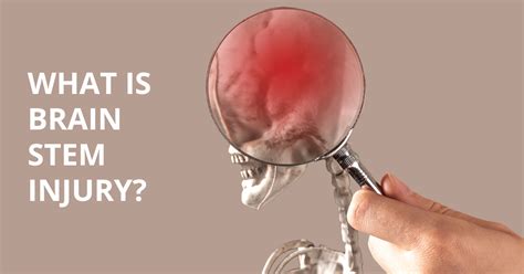 Brain Stem Injury Explained: Causes & Symptoms