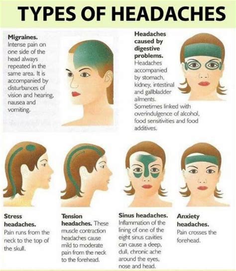 Migraine Remedies That Really Work | Migraines remedies, Headache types ...