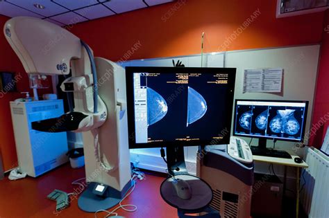 Contrast-enhanced digital mammography - Stock Image - C032/8549 ...