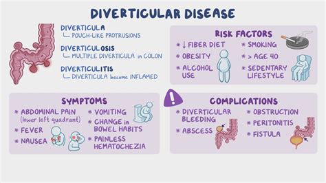 Diverticular disease: Nursing - Osmosis Video Library