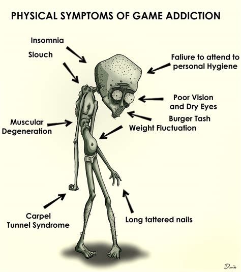 Seriousness of Games: Physical symptoms of game addiction