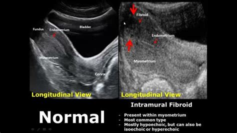 YouTube | Medical ultrasound, Ultrasound, Sonography