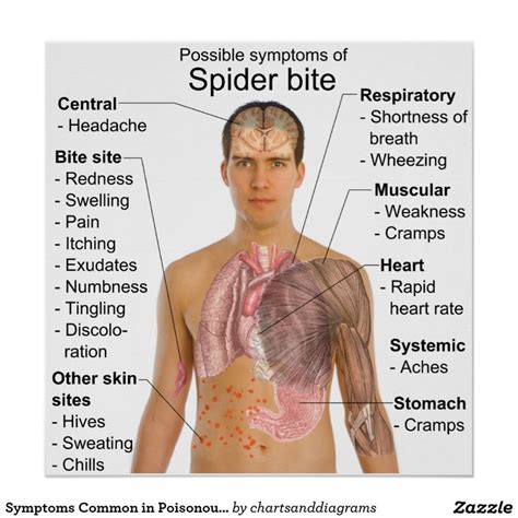 Signs Of A Poisonous Spider Bite Symptoms common in poisonous | Spider ...