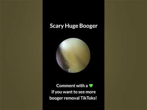 Huge Booger Removal - YouTube