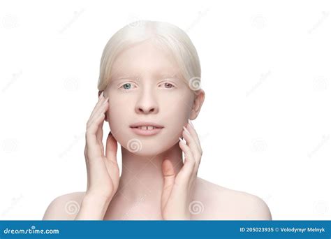 Beautiful Albino Woman with Heterochromia Isolated on White Studio ...