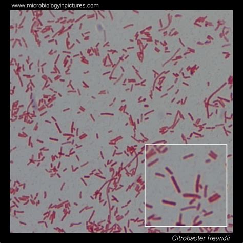 Citrobacter. Gram stain and cell morphology. Citrobacter freundii ...