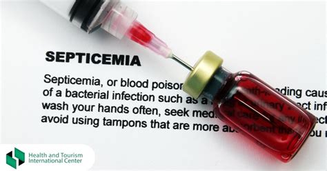 Septicemia - How to guess the symptoms? - HTI CENTERS | Medical Tourism ...