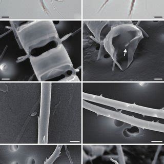 Chaetoceros coarctatus (A, light microscope; B-I, scanning electron ...