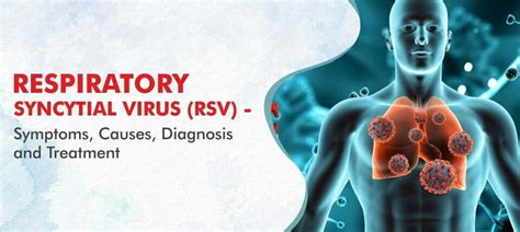 Respiratory Syncytial Virus - Symptoms, Causes & Treatment