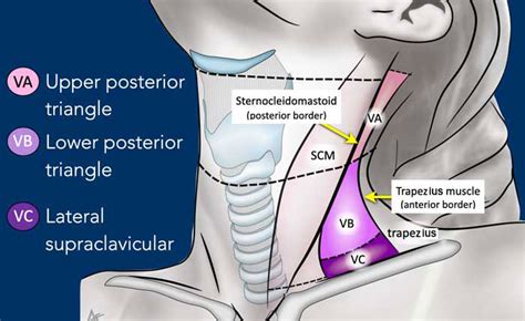 The Radiology Assistant : Cervical Lymph Node Map (2024)