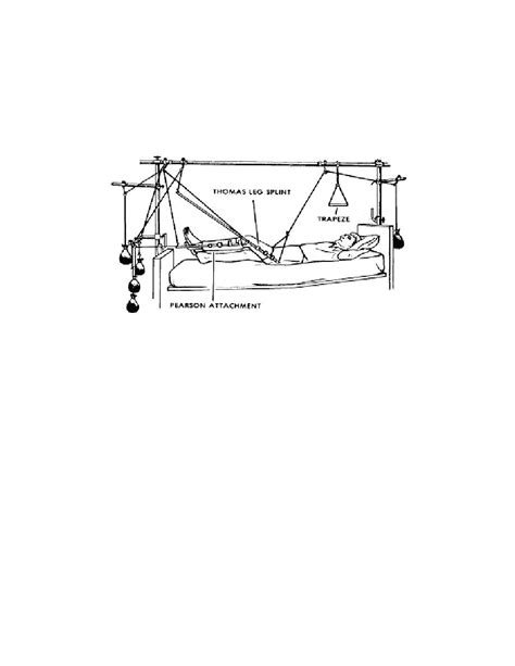 Figure 1-16. Balanced suspension traction. - Nursing Care ...