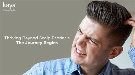 Scalp Psoriasis: Causes, Symptoms And Treatment Options - Blog