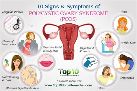 10 Common Signs and Symptoms of Polycystic Ovary Syndrome (PCOS) You ...