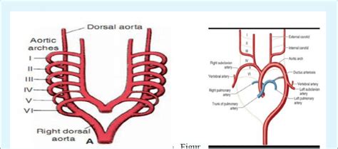 Embryology of Arch of Aorta. | Download Scientific Diagram