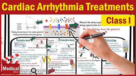 Pharmacology [CVS] 14- Cardiac Arrhythmia Treatments [Class 1 ...