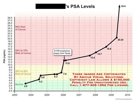 Psa Levels Chart: A Visual Reference of Charts | Chart Master