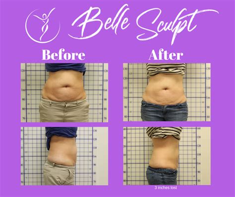 Before & After Sculpt-Stomach 3 - Healthworks