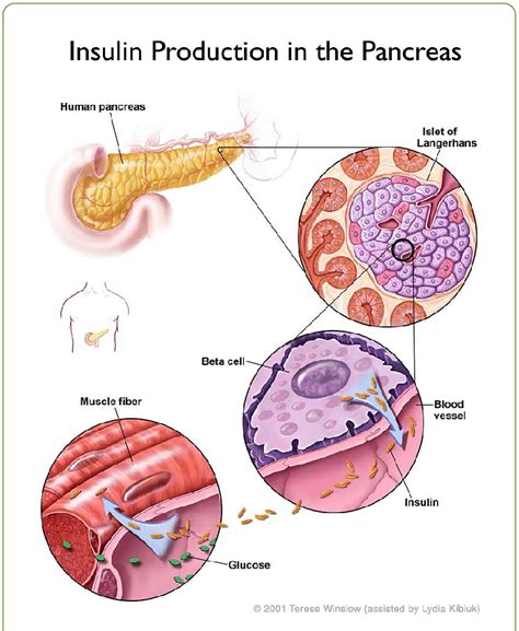 Insulin Which Is Produced by the Pancreas Is Used to...