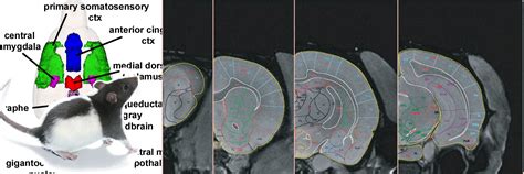 Rat Brain Atlas - Ekam Imaging