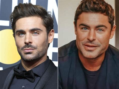 What's behind Zac Efron's 'new' cheeks and jawline, according to experts