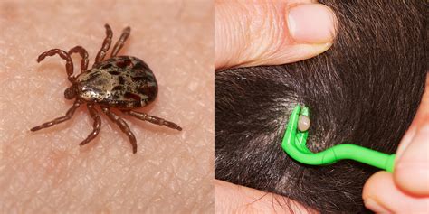 5 Tick Identification And Removal Tips | SELF