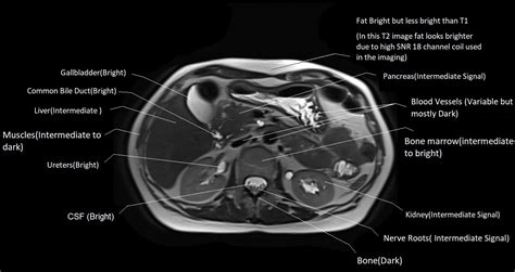 T1 vs T2 MRI | T1and T2 MRI image comparison