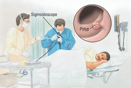 Patient Basics: Sigmoidoscopy | 2 Minute Medicine