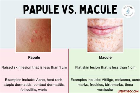 Papule vs Macule: Pictures, Differences, and Causes