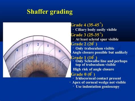 Gonioscopy presentation