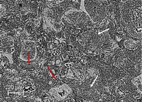 Typical microstructure of Al7075 deposit [34]. | Download Scientific ...