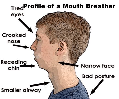 Mouth Breating vs Nasal Breating - Posturepro