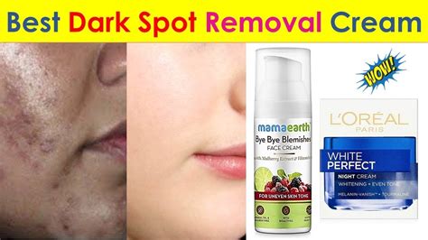 5 Best Dark Spot Removal Cream in India 2020 with Price - Anti ...