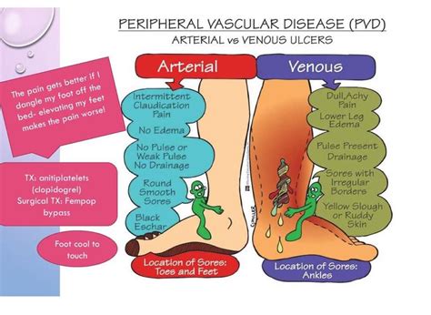 PAD VS PVD | Nursing mnemonics, Nursing school survival, Nursing school ...