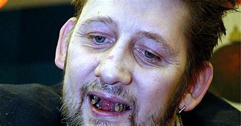 Fairytale of new TEETH! Shane MacGowan displays impressive new gnashers ...