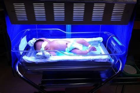 How Does Light Therapy Work For Jaundice In Newborns? Is It Safe For ...