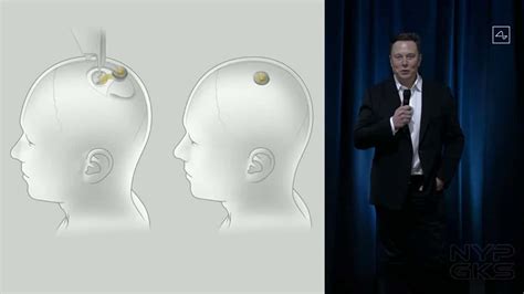 Neuralink brain implant prototype demoed by founder Elon Musk | NoypiGeeks