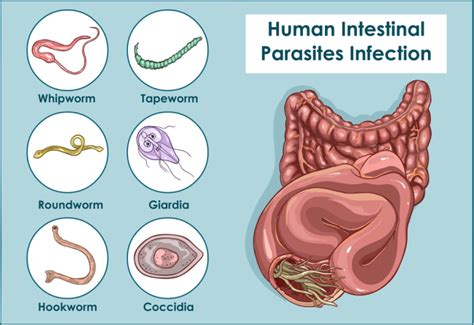 Dealing with Parasites: How to Heal Yourself - Food Storage Moms