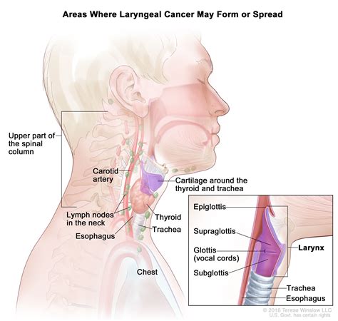 Squamous Cell Carcinoma Rectal Icd 10