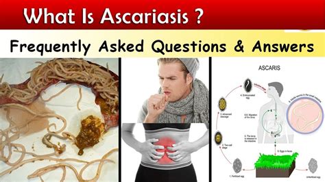 What is Ascariasis ? ( Ascaris Lumbricoids Infections - FAQ ) - YouTube