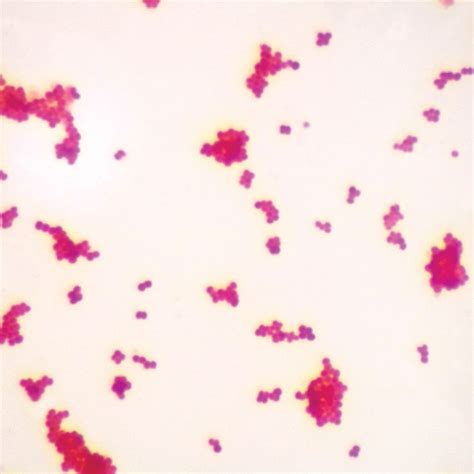 Gram-Negative Coccus, w.m. Gram Stain Microscope Slide | Carolina ...