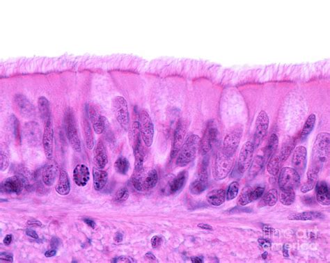 Pseudostratified Columnar Epithelium Histology Jotscroll