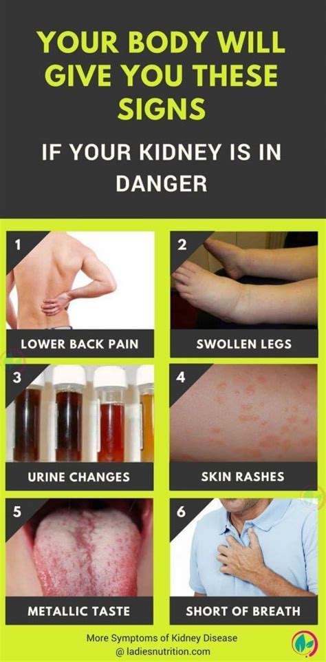 Early Symptoms Of Kidney Failure Urine