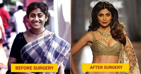 11 Bollywood Actress Who Have Allegedly Undergone Plastic Surgery