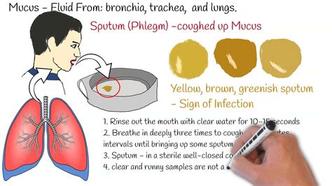 Sputum Test, (Phlegm Analysis), Sputum Culture, Sputum test, Sputum ...