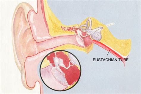 Ear blockage | Harley Street ENT Clinic