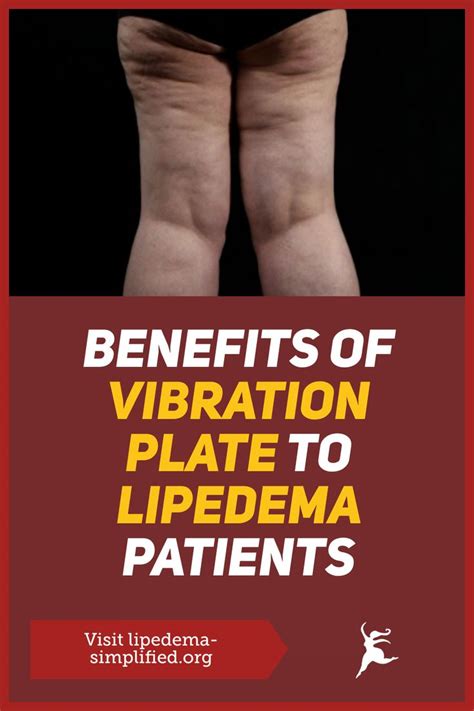 Lipedema Exercises