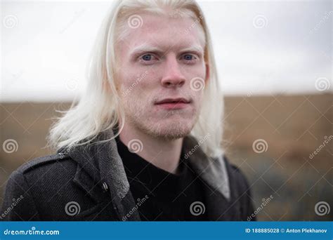 Portrait of a Young, Beautiful Albino Man with Blue Eyes. Stock Photo ...