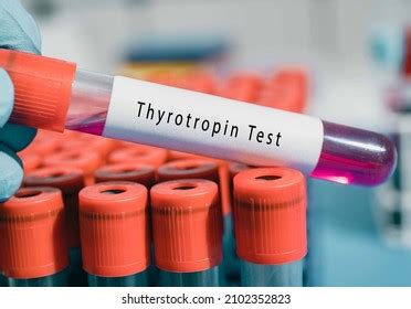 Hypothalamus Thyrotropin Releasing Hormone Trh Test Stock Photo (Edit ...