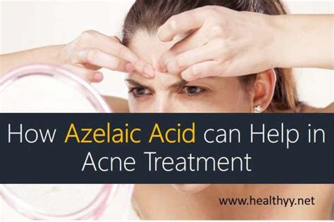 How Azelaic Acid can Help in Acne Treatment – Healthyy!