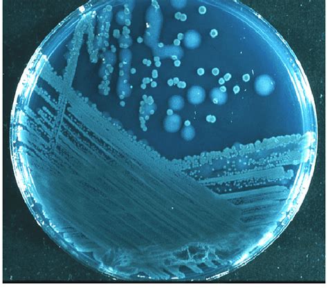 Pseudomonas aeruginosa ATCC 9027 - AGROTEKNO LAB